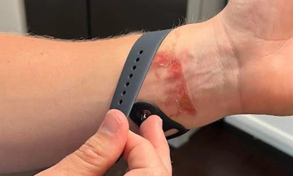 بهترین بند ساعت مناسب برای پوست حساس