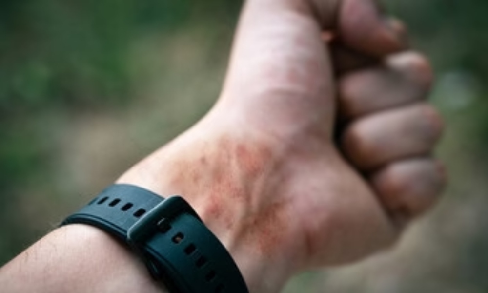 بند ساعت مناسب برای پوست حساس